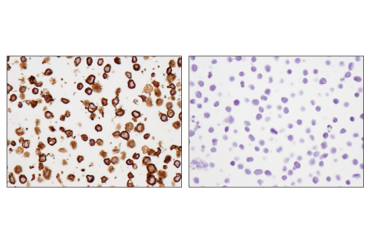 Immunohistochemistry Image 4: CD79B (D7V2F) Rabbit mAb (BSA and Azide Free)