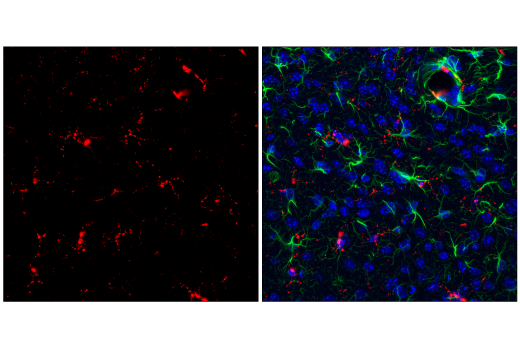 Immunofluorescence Image 1: CD68 (E3O7V) Rabbit mAb