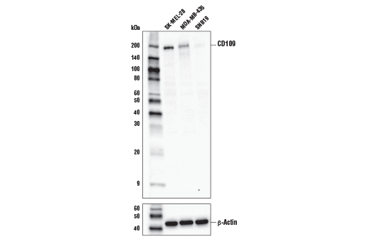 Western Blotting Image 1: CD109 Antibody