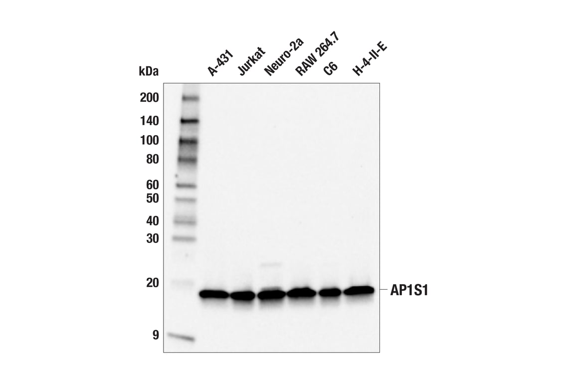 Western Blotting Image 1: AP1S1 (F8K5S) Rabbit mAb