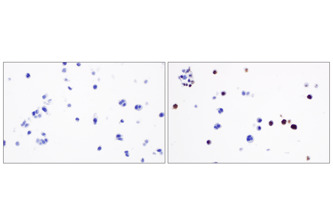 Immunohistochemistry Image 10: Phospho-Histone H3 (Ser10) (D7N8E) XP<sup>®</sup> Rabbit mAb (BSA and Azide Free)