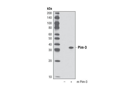 undefined Image 9: Pim Kinase Antibody Sampler Kit