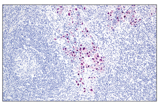 Immunohistochemistry Image 5: Sox10 (E6B6I) XP<sup>®</sup> Rabbit mAb (BSA and Azide Free)