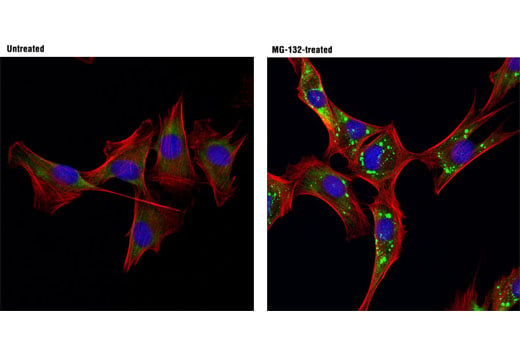 Immunofluorescence Image 1: FXR1 (D10A2) XP<sup>®</sup> Rabbit mAb