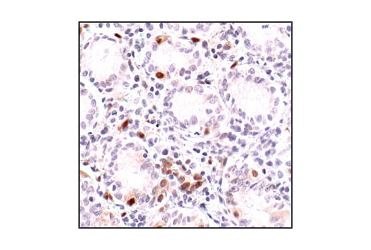 Immunohistochemistry Image 3: Phospho-Stat1 (Tyr701) (58D6) Rabbit mAb (BSA and Azide Free)