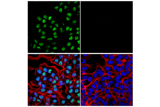 Immunofluorescence Image 1: ADAR1 (E6X9R) XP<sup>®</sup> Rabbit mAb (Alexa Fluor<sup>®</sup> 488 Conjugate)