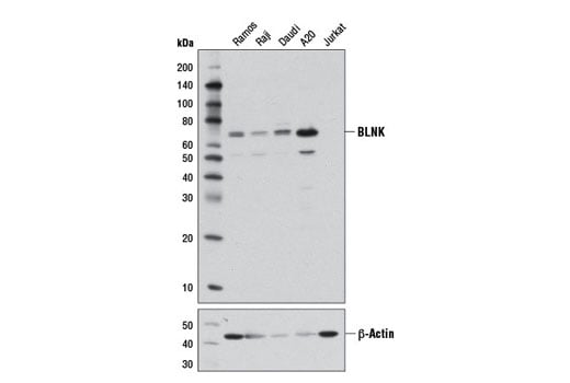 Western Blotting Image 1: BLNK (D8R3G) Rabbit mAb