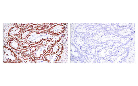 Immunohistochemistry Image 2: 53BP1 (E7N5D) XP<sup>®</sup> Rabbit mAb (BSA and Azide Free)