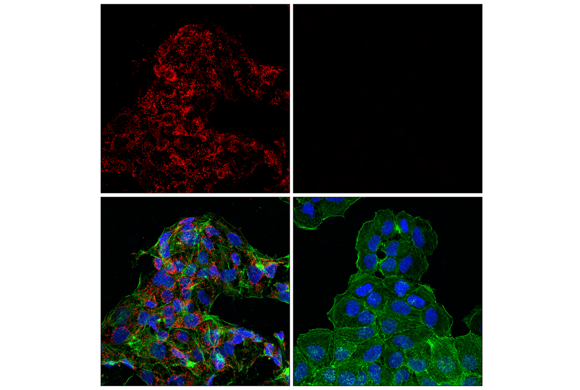 Immunofluorescence Image 1: Catalase (D4P7B) XP<sup>®</sup> Rabbit mAb (Alexa Fluor<sup>®</sup> 647 Conjugate)