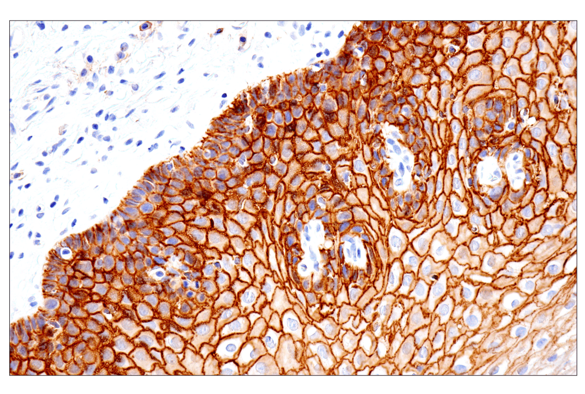 Immunohistochemistry Image 4: Syndecan 1 (E7F7T) Rabbit mAb