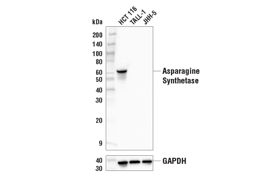 Western Blotting Image 2: Asparagine Synthetase (E6C2C) XP<sup>®</sup> Rabbit mAb (BSA and Azide Free)
