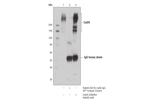 Immunoprecipitation Image 1: CaSR (D6D9V) Rabbit mAb