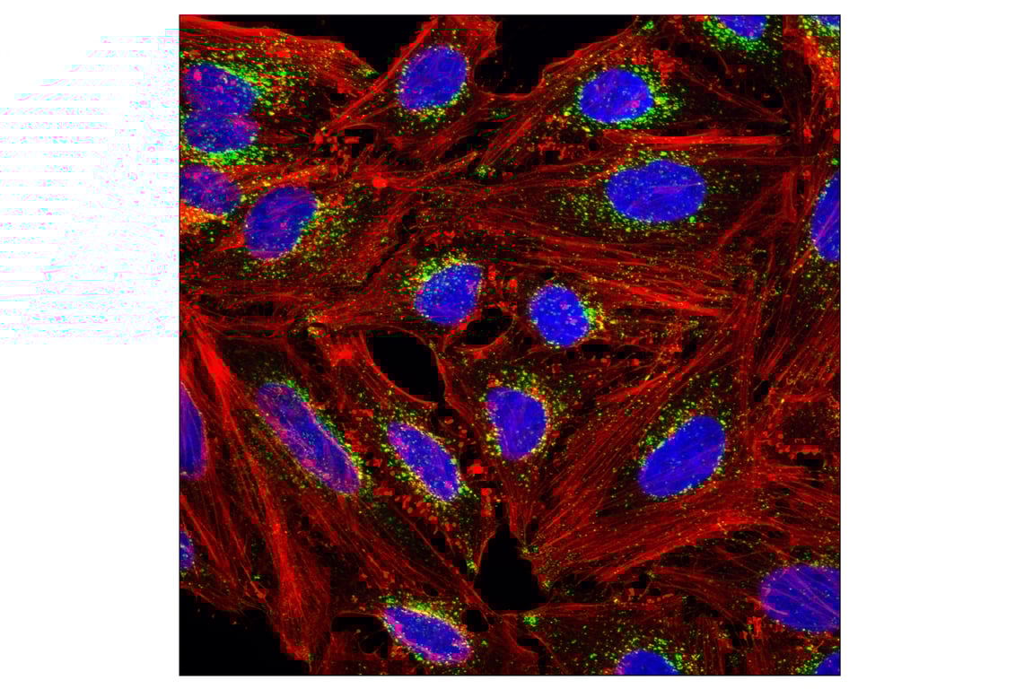 undefined Image 29: PICALM Signaling Antibody Sampler Kit