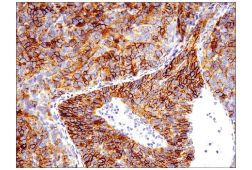 Immunohistochemistry Image 1: EpCAM (E6V8Y) XP<sup>®</sup> Rabbit mAb (BSA and Azide Free)