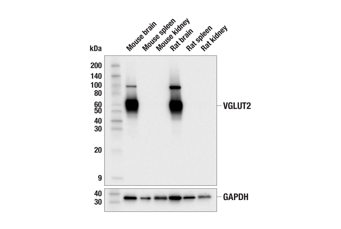 Western Blotting Image 1: VGLUT2 (E7P9K) Rabbit mAb