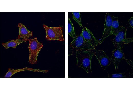 Immunofluorescence Image 2: Phospho-Tyrosine Mouse mAb (P-Tyr-100)