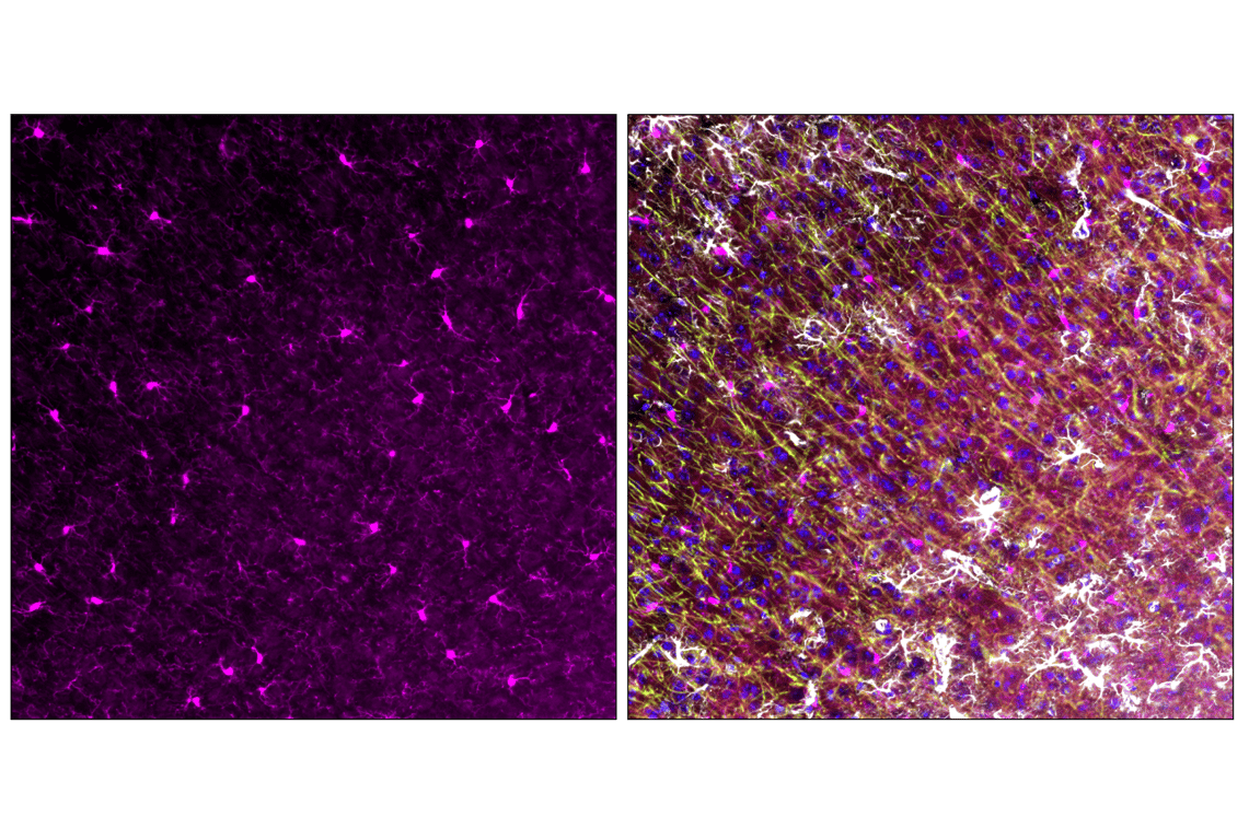 Immunofluorescence Image 3: Iba1/AIF-1 (E4O4W) XP<sup>®</sup>  Rabbit mAb (Alexa Fluor<sup>®</sup> 647 Conjugate)