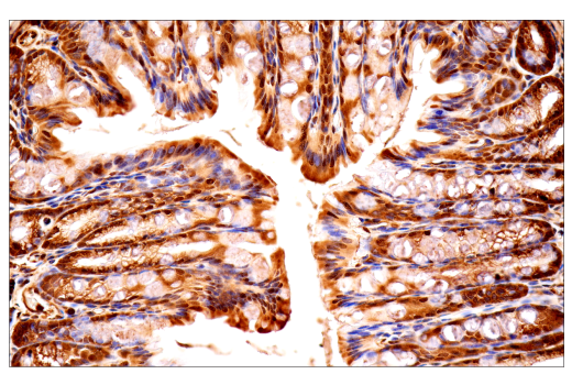 Immunohistochemistry Image 14: Ubiquitin (E6K4Y) XP<sup>®</sup> Rabbit mAb (BSA and Azide Free)