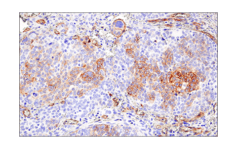 Immunohistochemistry Image 1: CD200 (E5I9V) XP<sup>®</sup> Rabbit mAb (BSA and Azide Free)