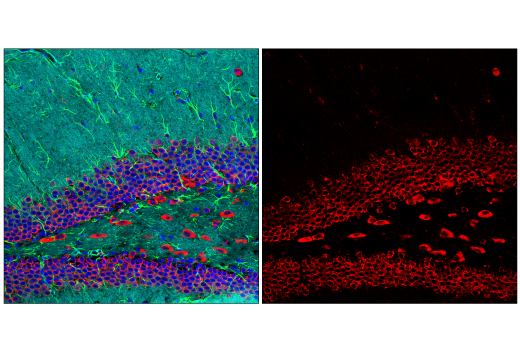 Immunofluorescence Image 1: YTHDF2 (E2I2H) Rabbit mAb