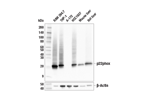Western Blotting Image 1: p22phox (E7Y1F) XP® Rabbit mAb
