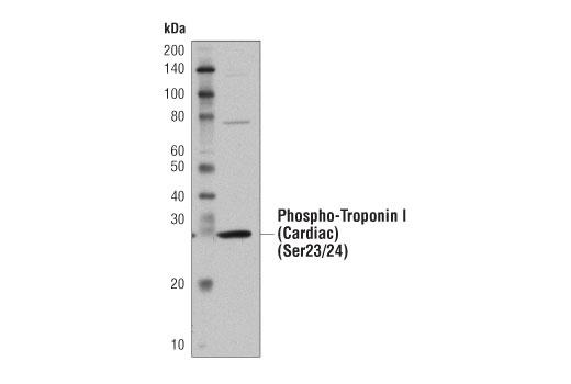 Western Blotting Image 1: Mouse Heart Tissue Control Extracts