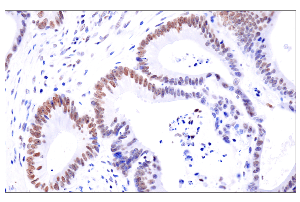 Immunohistochemistry Image 2: Acetyl-Histone H4 (Lys16) (E2B8W) Rabbit mAb