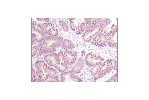 Immunohistochemistry Image 1: Axin1 (C76H11) Rabbit mAb