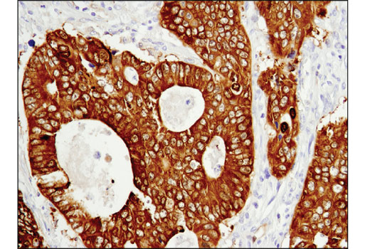 Immunohistochemistry Image 1: ASS1 (D4O4B) XP<sup>®</sup> Rabbit mAb
