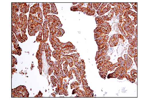undefined Image 12: Branched-Chain Amino Acid Metabolism Antibody Sampler Kit