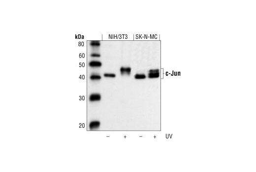 undefined Image 6: PhosphoPlus<sup>®</sup> c-Jun (Ser73) Antibody Duet