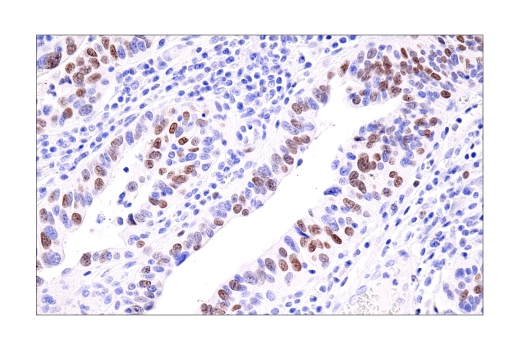 Immunohistochemistry Image 3: ATAD2 (E8Y7F) Rabbit mAb