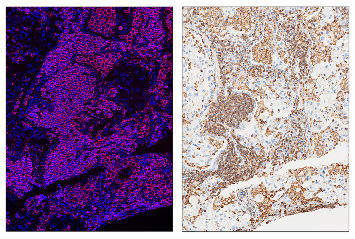 Immunohistochemistry Image 6: CD45 (Intracellular Domain) (D9M8I) & CO-0013-488 SignalStar<sup>™</sup> Oligo-Antibody Pair