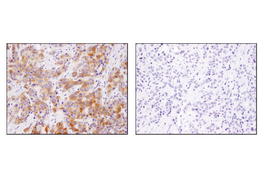 Immunohistochemistry Image 4: INPP4b (D9K1B) XP<sup>®</sup> Rabbit mAb