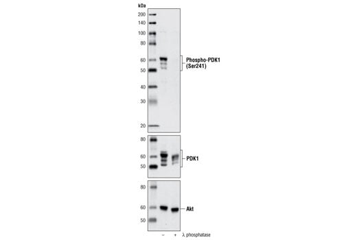 undefined Image 6: Phospho-Akt Pathway Antibody Sampler Kit