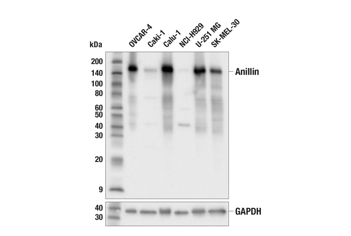 Western Blotting Image 1: Anillin (E9L6E) Rabbit mAb