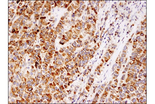 Immunohistochemistry Image 1: Bcl-2 (124) Mouse mAb