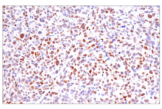 Immunohistochemistry Image 6: Bcl-3 (E4D4K) Rabbit mAb