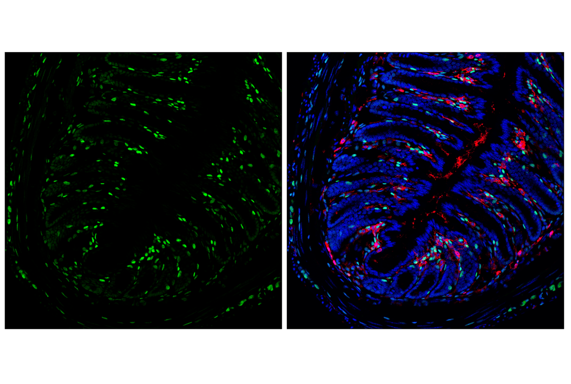 Immunofluorescence Image 1: TCF4/ITF2 (E3X2Y) Rabbit mAb