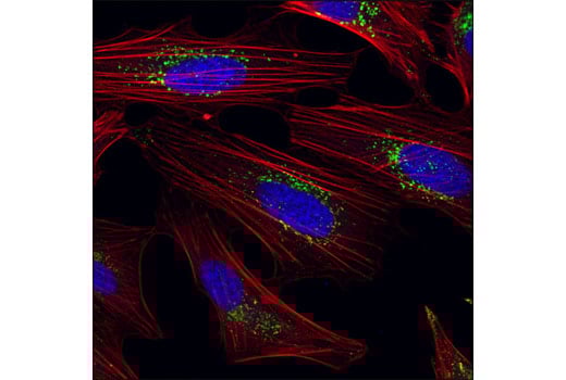 undefined Image 16: Rag and LAMTOR Antibody Sampler Kit