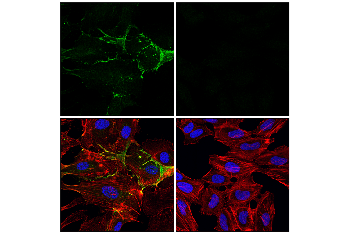 Immunofluorescence Image 1: CD31 (PECAM-1) (89C2) Mouse mAb (Alexa Fluor<sup>®</sup> 488 Conjugate)