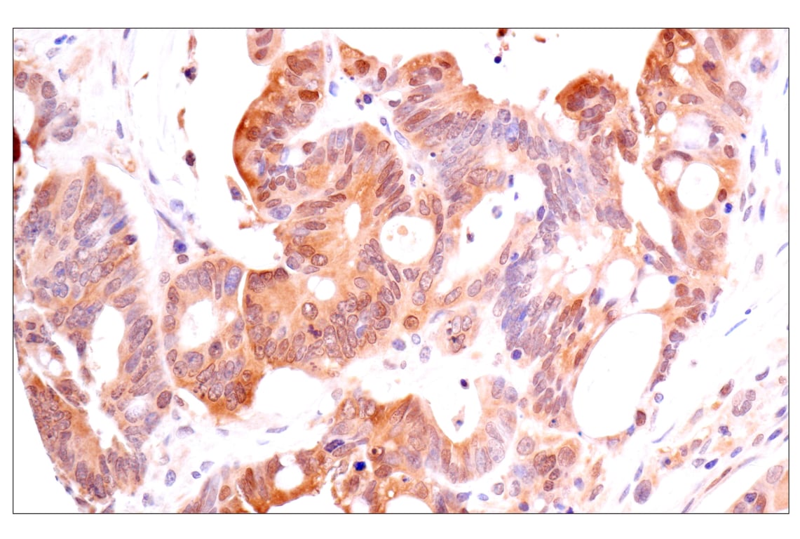 Immunohistochemistry Image 2: ACBP/DBI (E6K8G) XP<sup>®</sup> Rabbit mAb