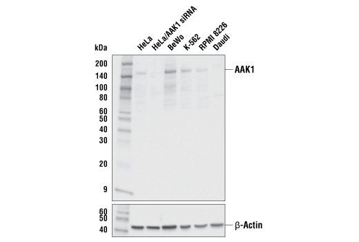 Western Blotting Image 2: AAK1 (E8M3P) Rabbit mAb