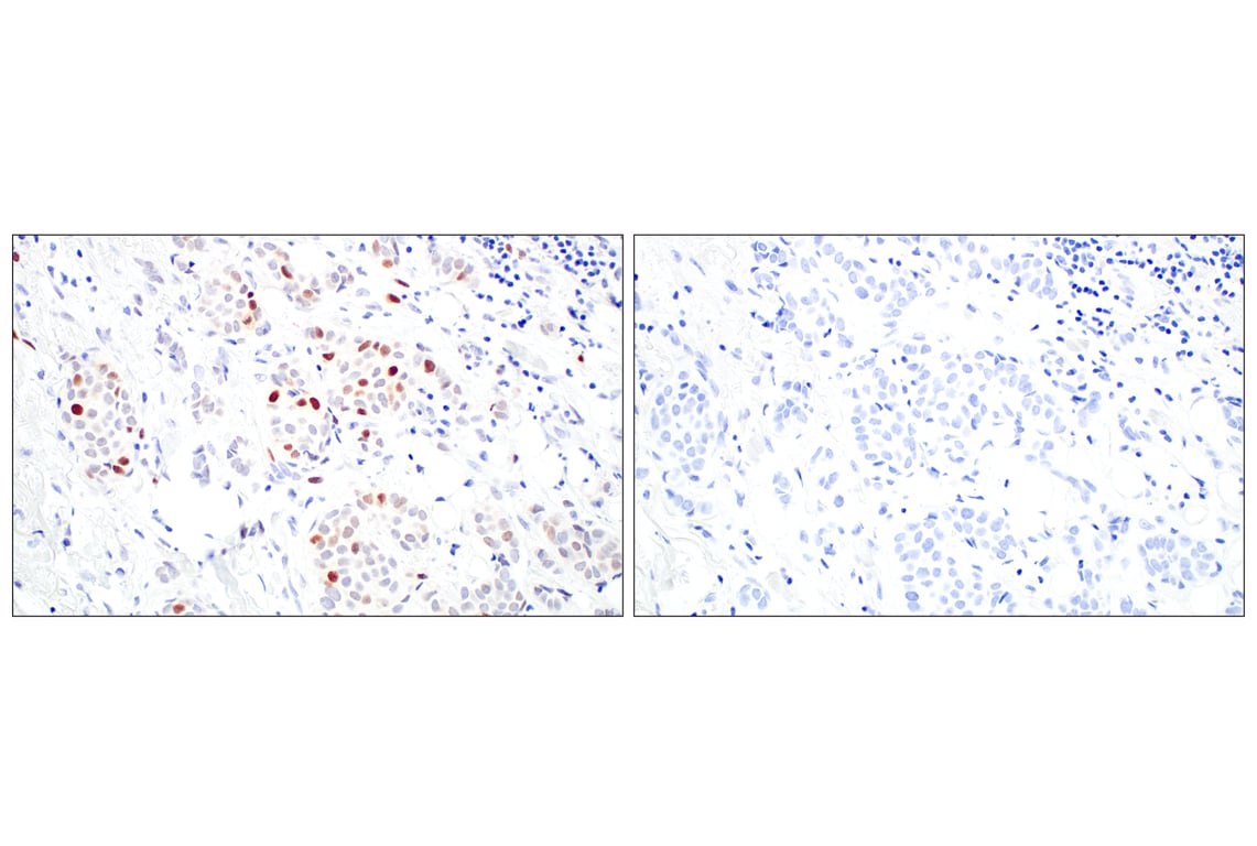 Immunohistochemistry Image 10: BRCA1 (E5S9G) Rabbit mAb