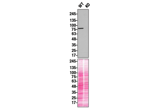 undefined Image 27: Xenophagy Antibody Sampler Kit