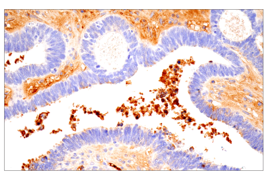 Immunohistochemistry Image 2: IgA (N1CLA) Mouse mAb