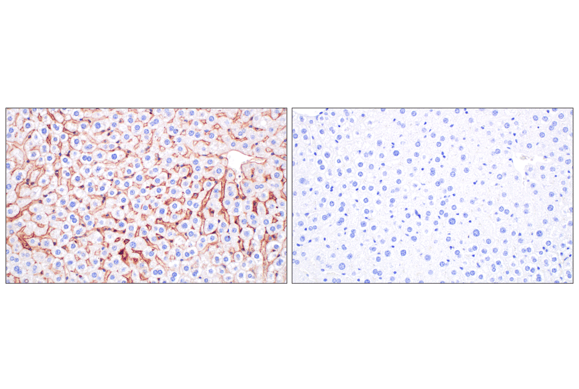 Immunohistochemistry Image 7: PNPLA3 (E7N6O) Rabbit mAb