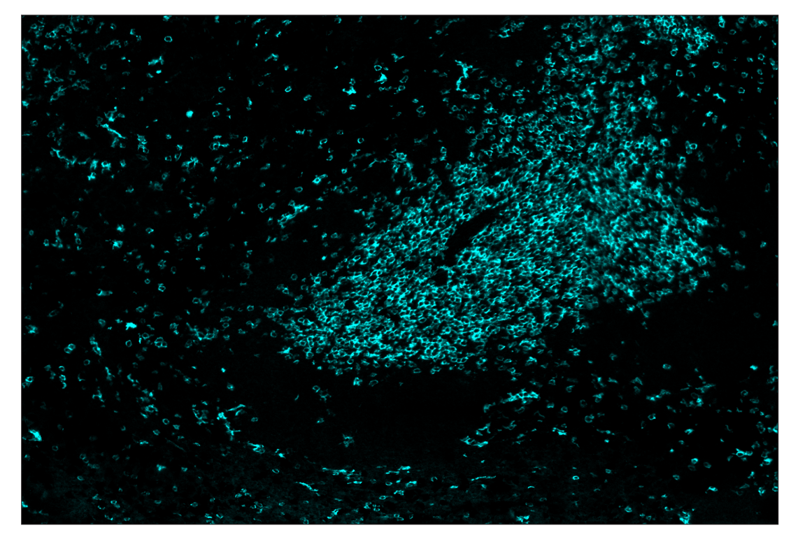 Immunohistochemistry Image 5: CD8α (D4W2Z) & CO-0040-488 SignalStar<sup>™</sup> Oligo-Antibody Pair