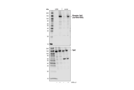 Western Blotting Image 1: Phospho-Tyk2 (Tyr1054/1055) (D7T8A) Rabbit mAb