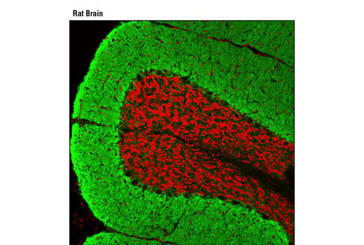 Immunofluorescence Image 1: EAAT1 (D44E2) XP<sup>®</sup> Rabbit mAb